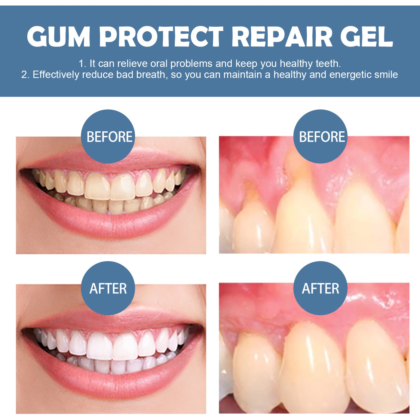 Reblumen® Gingival Repair Gel, With Significant Effect in 7 Days